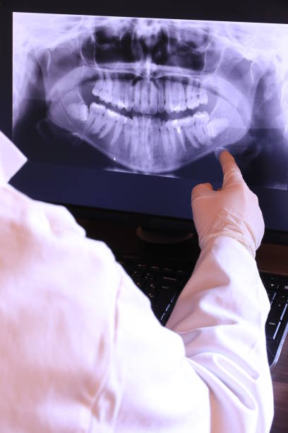 Best Emergency Dentist for Knocked-Out Tooth in Roaring Spring, PA